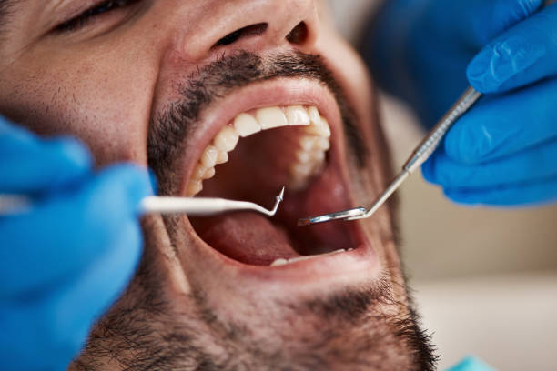 Best Dentist for Tooth Abscess  in Bay, AR